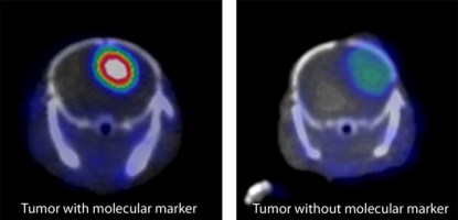 Images by Weibo Cai/Department of Radiology, University of Wisconsin-Madison. On the left, the antibody is linked to a label that shows up in a PET scanner, and the aggressive cancer shines brightly. On the right, a similar cancer without the molecular marker is less obvious.
