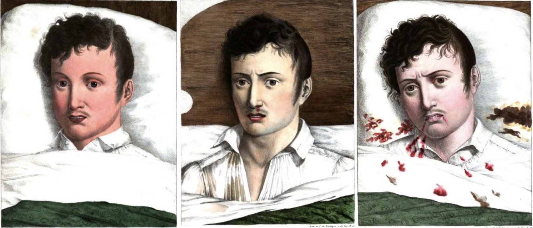 Development of Yellow Fever_crop.png